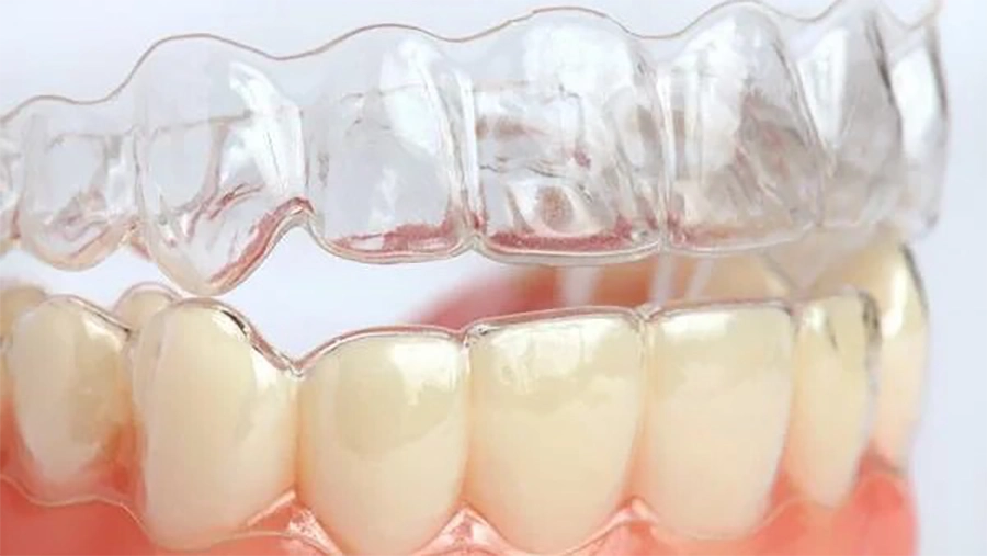 Hướng Dẫn Chăm Sóc Sau Niềng Răng