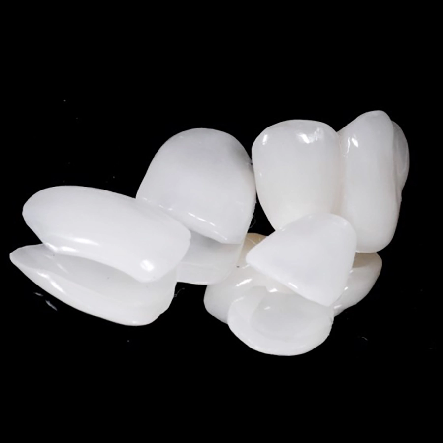 Phương Pháp Dán Sứ Veneer: Ưu & Nhược Điểm